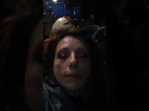 22 settimane di gravidanza mal di terzino destro Distrugge larticolazione del ginocchio