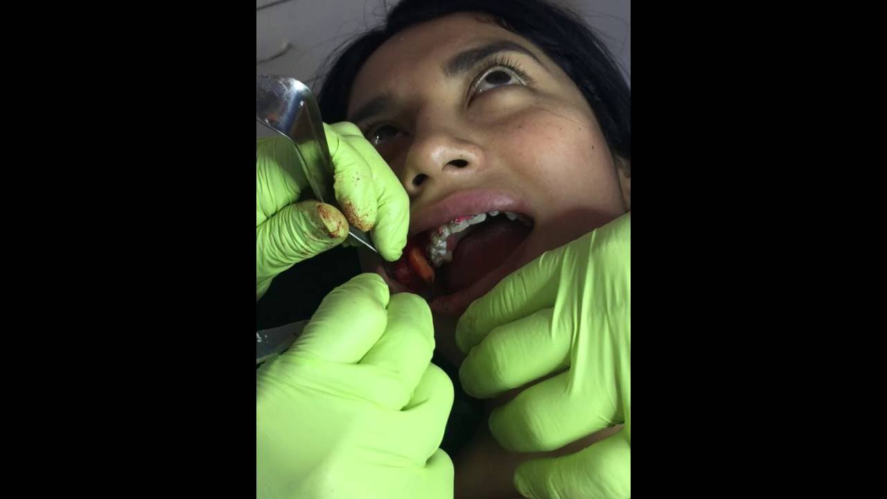 Jonathan Bermudez Gonzalez-7