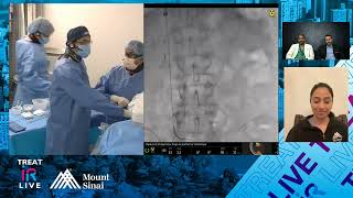 Complex IVC Filter Retrieval