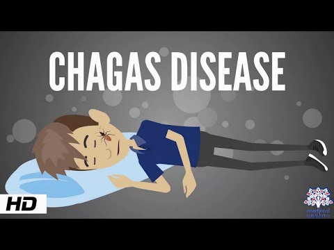 Chagas Disease, Causes, Signs and Symptoms, Diagnosis and Treatment