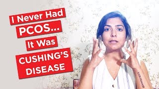 I Never Had PCOS... It Was Cushing
