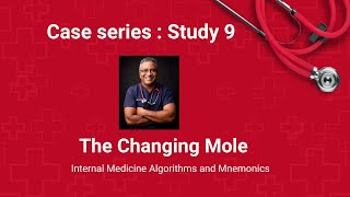 Clinical Case Study 9 : The Changing Mole