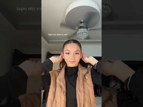 No more Protruding Ears #shorts