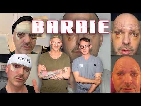 Barbie unter'm Messer: Gliding Browlift, Tränensäcke entfernen und Skin Pinch