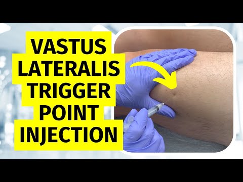 Trigger Point Injection Vastus Lateralis Technique
