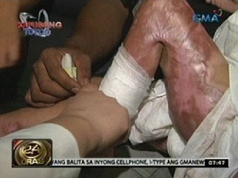Douches slimming Mawalan ng timbang sa isang araw, 200 gramo