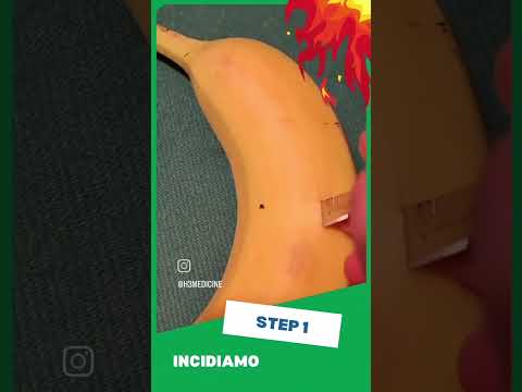 Come si sutura una banana? #short #surgery