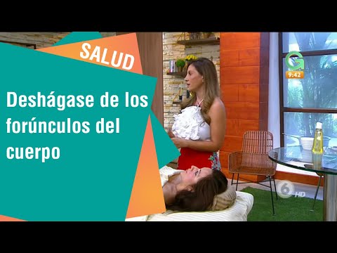 Deshágase de los forúnculos del cuerpo | Salud
