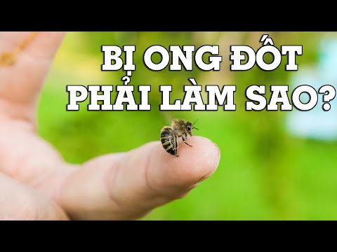 , title : 'Cách xử lý vết ong đốt và phòng tránh khi bị ong đốt - Mẹo Vặt Cuộc Sống'