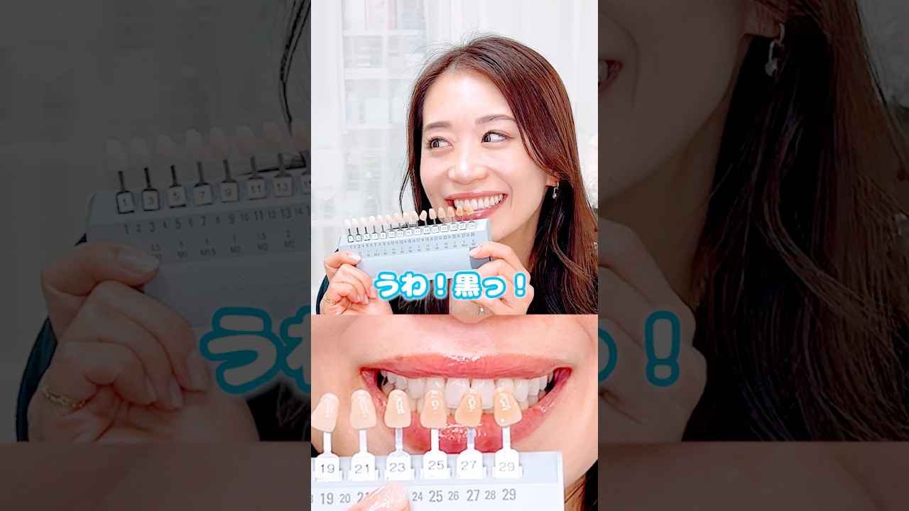 歯の色で年齢変わるよ‼️#歯医者#前歯#美容#トランセントホワイトニング#美人女医りさ先生のクリニックはこちら💁‍♀️http://ginzashinbashidental.com/