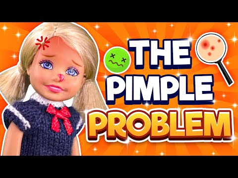 Barbie - The Pimple Problem | Ep.360