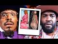 Anyone With A BBL Has A Mental Illness Corey Holcomb On The BBL Epidemic