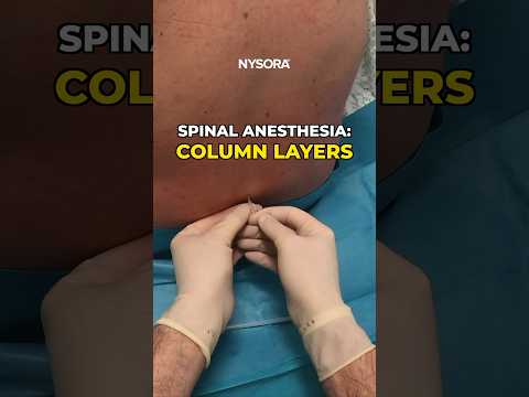 Spinal Anesthesia: Layers #spinal #anesthesia #layers