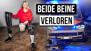 Wie ist das BEIDE BEINE ZU VERLIEREN