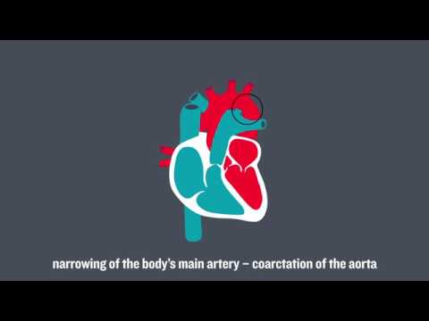 Congenital Heart Conditions
