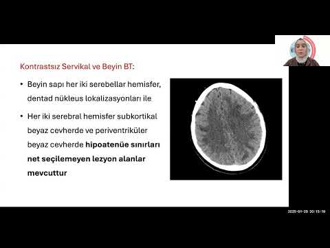 Emek Gerektiren Olgular EGO 29 ocak 2025