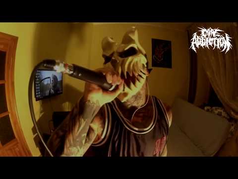 Dickie Allen vs Alex Terrible (Vocal Battle)