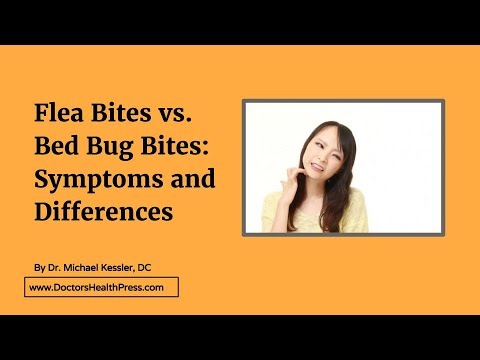 Flea Bites vs. Bed Bug Bites: Symptoms and Differences | Doctors Health Press