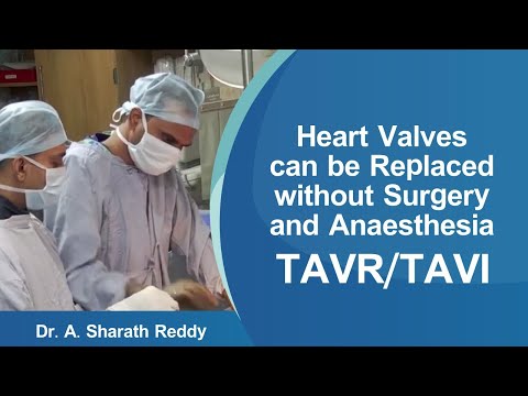 Heart Valves can be Replaced without Surgery and Anaesthesia | TAVI | TAVR | Medicover Hospitals