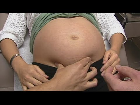 Study has doctors urging pregnant women to take additional COVID-19 precautions