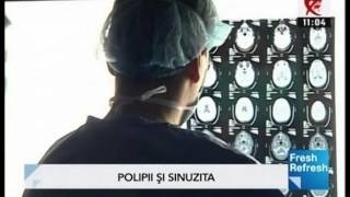 interviu RINO SINUZITA POLIPOASA Dr  Bogdan MOCANU REALITATEA TV