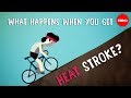 What happens when you get heat stroke? - Douglas J. Casa