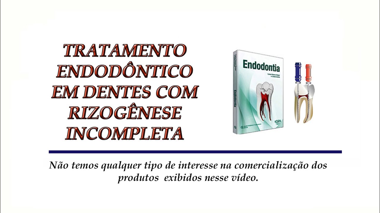 Tratamento endodôntico em dentes com rizogênese incompleta
