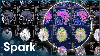 בתוך הניסויים שמנסים להוכיח את קיום הטלפתיה