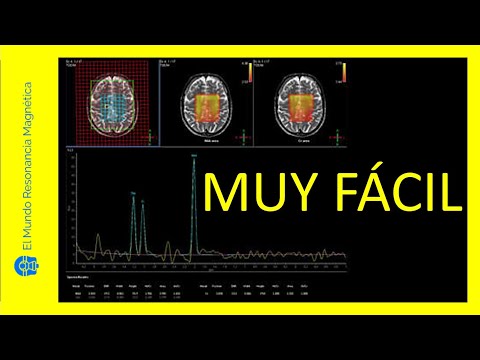 Vídeo 22✔¿Sabías que la Espectroscopia por Resonancia Magnética es MUY FÁCIL?👍 Revelamos su Secreto
