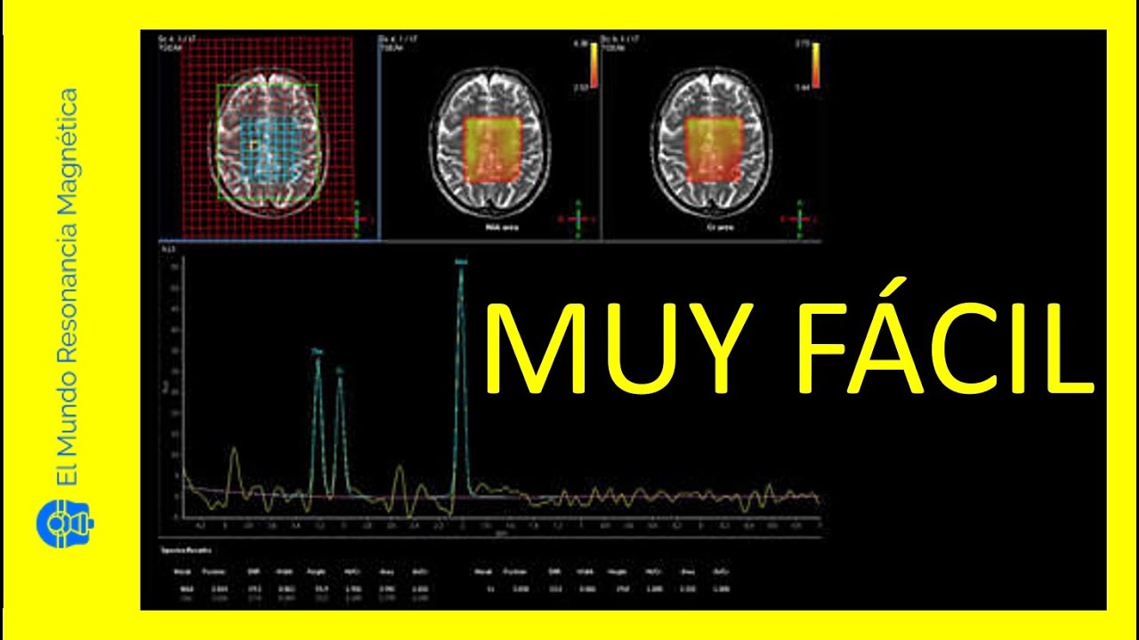 Vídeo 22✔¿Sabías que la Espectroscopia por Resonancia Magnética Nuclear es MUY FÁCIL👍Secuencias RMN