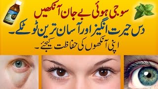 10 Best Home Remedies to Cure Puffy & Swollen Eyes will Make them Beautiful