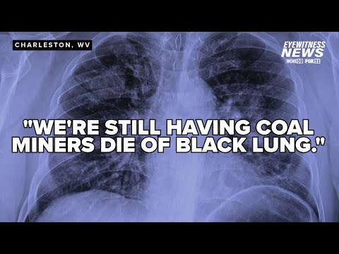 Black lung cases continue to rise while preventative measures stall out
