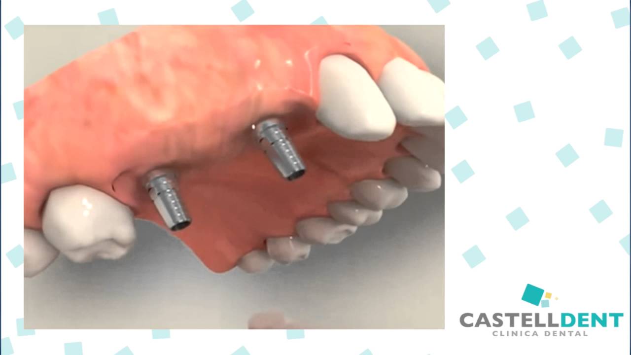 Ruben Dario Lopez Cruz-23