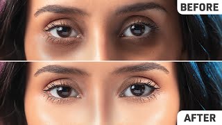 Remove Dark Circles Permanently FAST! | Natural Home Remedies