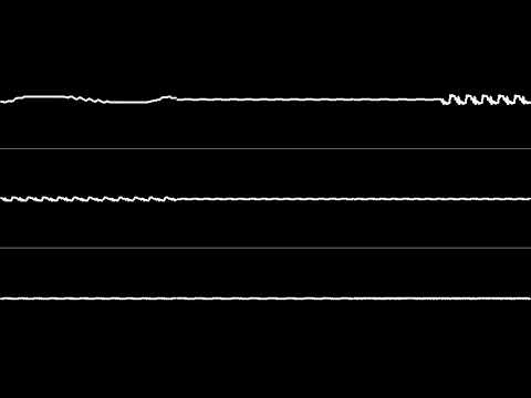 [X68000 YM2151, MSM6258V] Doukyuusei, School Theme (Oscilloscope View)