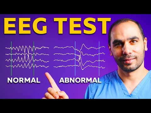 EEG Test: Epilepsy Neurologist Explains