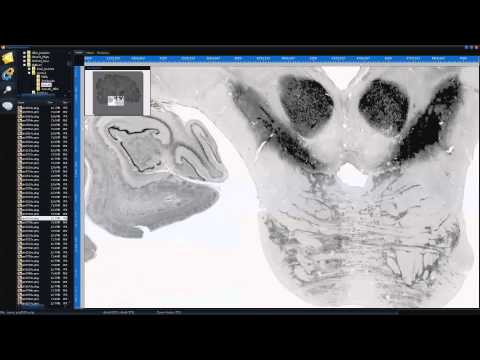 BigBrain Viewer 2D Image Tutorial