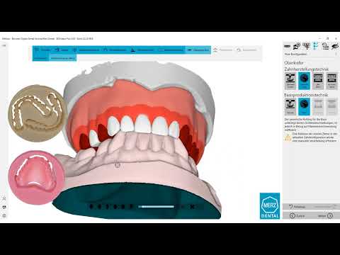 BDCreator PLUS: BDLoad bis File Split - neue Möglichkeiten (de) #BalticDentureSystem #DigitalDenture