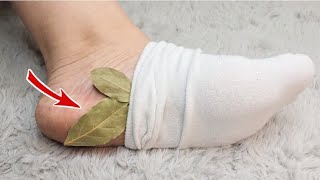 I would die and not know! Put a bay leaf on your feet and don't spend money at the market