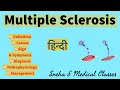 Multiple Sclerosis !! Definition!! causes !! Sign & symptoms!! pathophysiology!! Management!!
