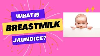 Breastmilk jaundice. Breastfeeding jaundice. Dr Sridhar K #bilirubin #neonataljaundice #breastmilk