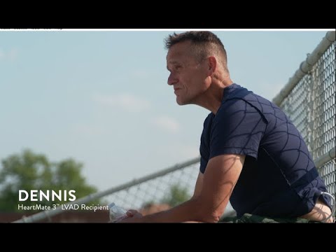 Dennis’ Patient Story: Living with HeartMate 3 LVAD for Heart Failure