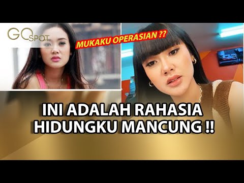 MUKA OPERASI, CITA CITATA NGAKU MUKA NYA BERUBAH !! KARENA INI … - GO SPOT