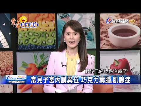 月經走了還在痛  難纏子宮內膜異位症