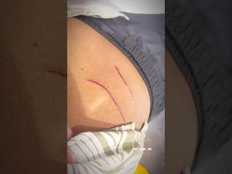 Duke 390 crash 🥺 #duke390 #ktm #crash #accident