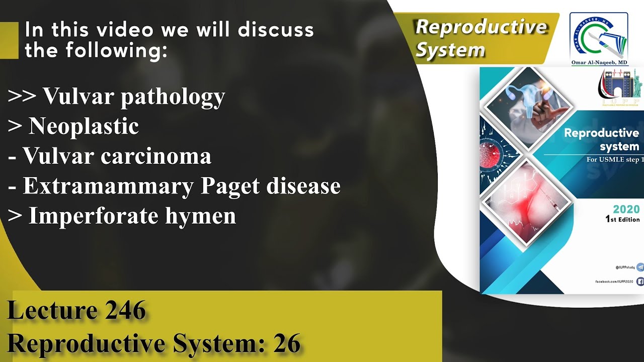 Vulvar carcinoma | Extramammary Paget disease | Imperforate hymen
