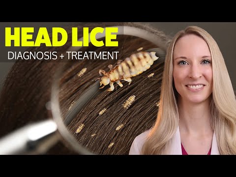 HEAD LICE: Diagnosis, Treatment, Home Remedies, Tips from a dermatologist for self treatment