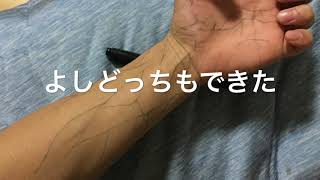 閲覧注意手と腕の神経をなんとなく書いたのを見たらちょいとキモかった