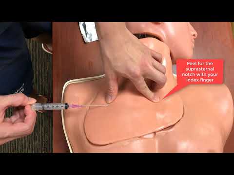 Central Venous Catheterization - subclavian vein