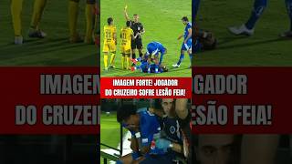 IMAGEM FORTE! JOGADOR DO CRUZEIRO SOFRE LESÃO FEIA APÓS LEVAR ENTRADA FORTÍSSIMA CONTRA O MIRASSOL!